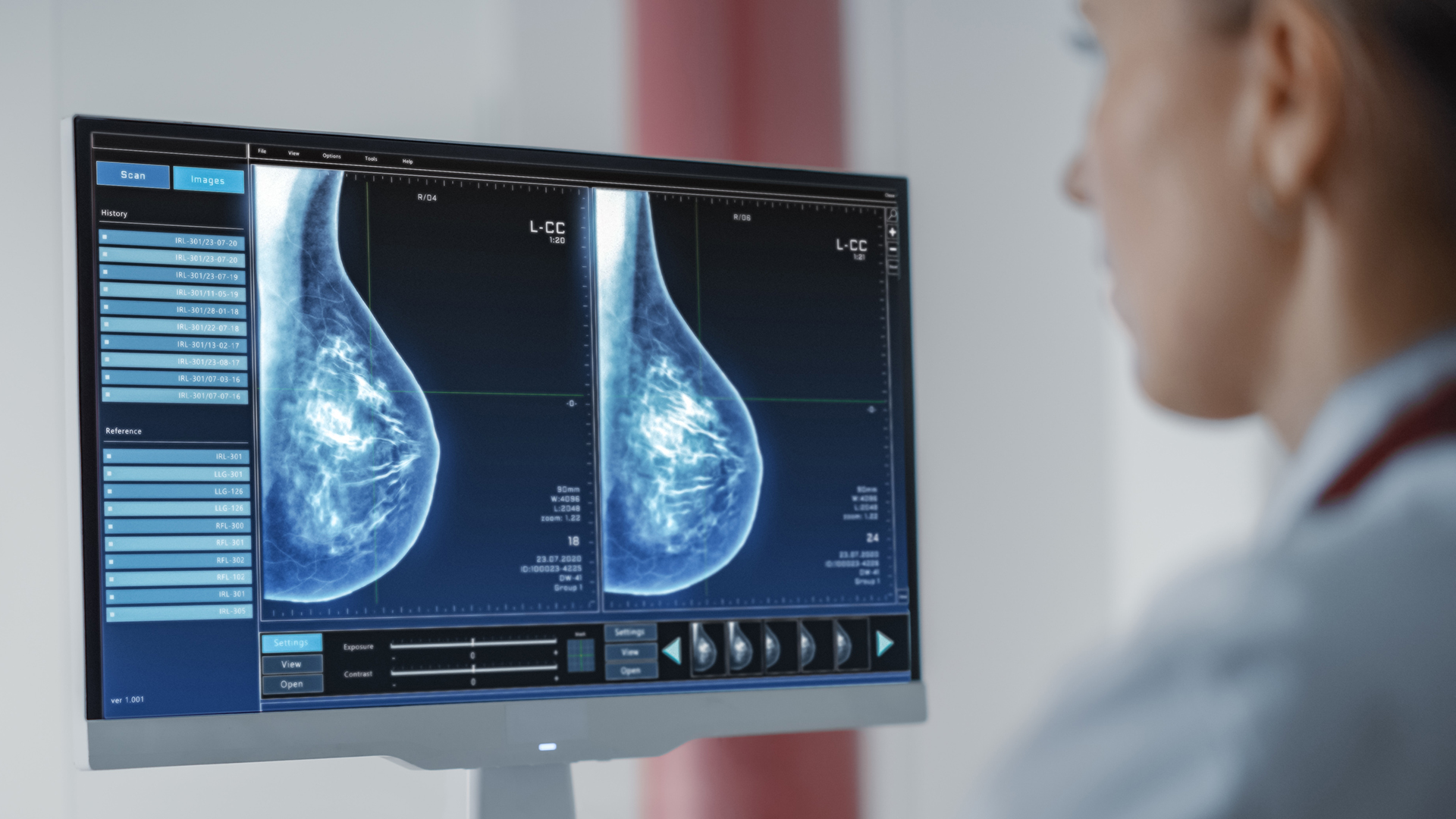 NVIDIA Shows How AI Is Speeding Up Breast Cancer Screening and Treatment